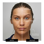 Kit Facial Antiedad Completo de CurrentBody Skin (Máscara LED Serie 1)