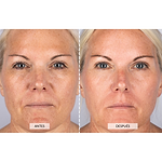 Kit Facial Antiedad Completo de CurrentBody Skin (Máscara LED Serie 1)