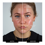 ZIIP HALO Dispositivo de microcorriente facial Oferta