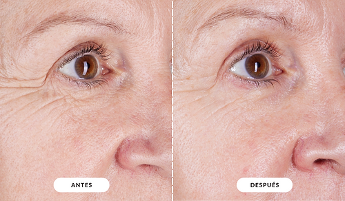 Antes