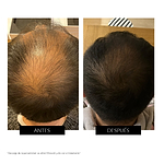 PR CurrentBody Skin LED Hair Regrowth Device - Black Friday