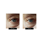 OXYjet GO Sistema facial de oxígeno