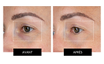 CurrentBody Skin LED Eye Perfector Offre