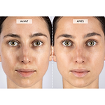 Masque LED visage - CurrentBody Skin Offre