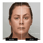 ZIIP HALO Facial Toning Device