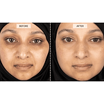 CurrentBody Skin LED Light Therapy Face Mask