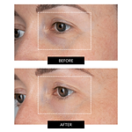 CurrentBody Skin LED Eye Perfector & 5 Eye Hydrogel Masks (del valore di 249€)