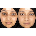 Kit LED di Nuova Generazione CurrentBody Skin - Black Friday