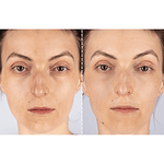 CurrentBody Skin X Peter Rabbit - Maschera di fototerapia a luce LED