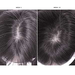 CurrentBody Skin LED Hair Regrowth - urządzenie na porost włosów