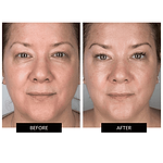 CurrentBody Skin LED Face Mask & Green Tea Serum (30ml)
