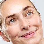 MICRONEEDLING_FORHEAD_MODEL