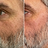 Reduce fine lines & wrinkles