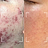 Blemishes