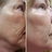Reduces fine lines & wrinkles