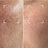 Improves skin texture
