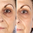 Increases collagen production