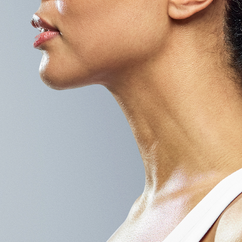 Woman's neck after using natural neck tightening treatments for turkey neck