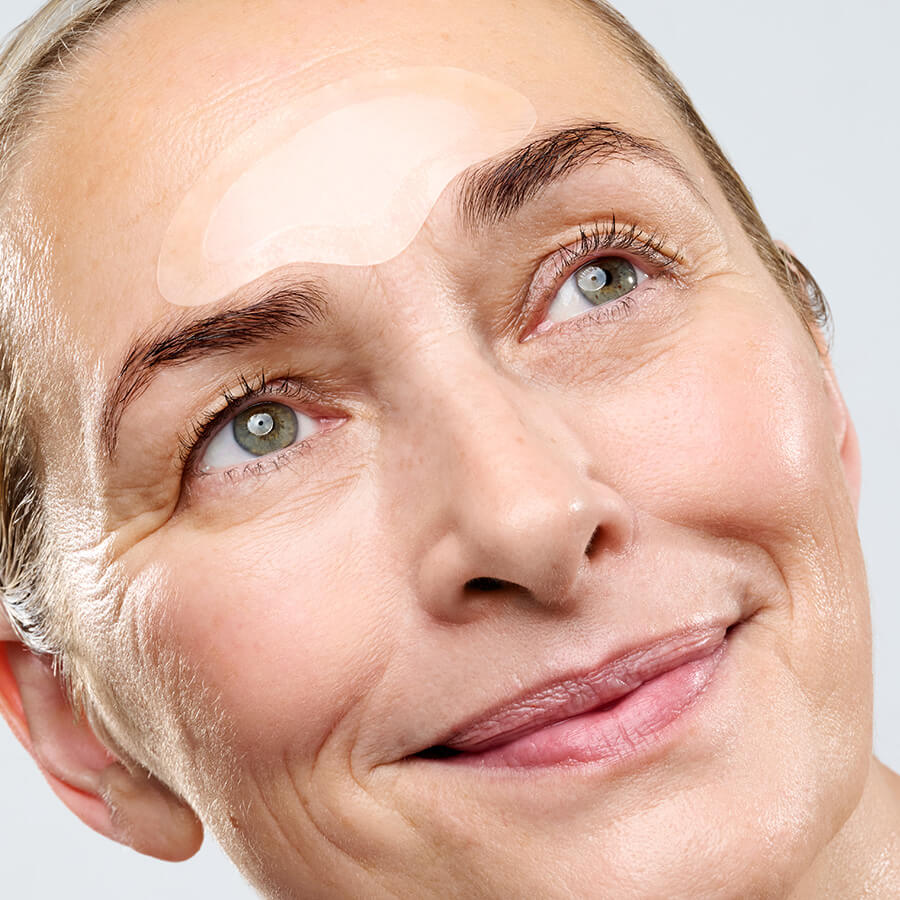 Microneedling Forehead Model
