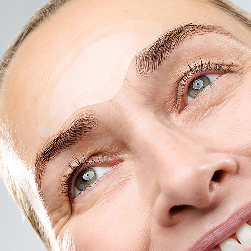 Microneedling Forehead Model