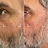 Reduz linhas finas e rugas