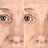 Suaviza visivelmente linhas e rugas