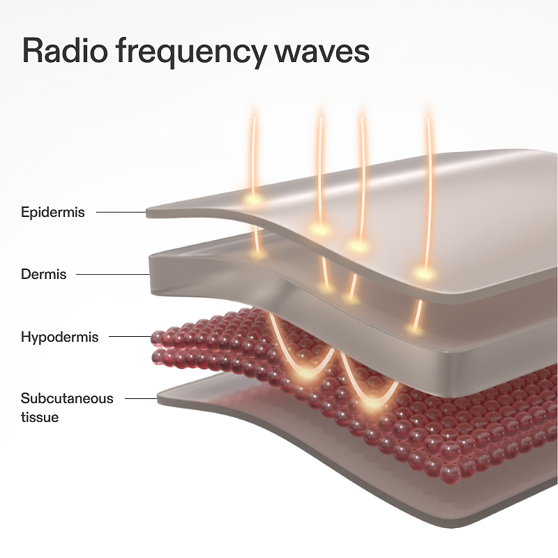 Diagram showing Radio frequency waves of CurrentBody RF device and their effects on skin layers
