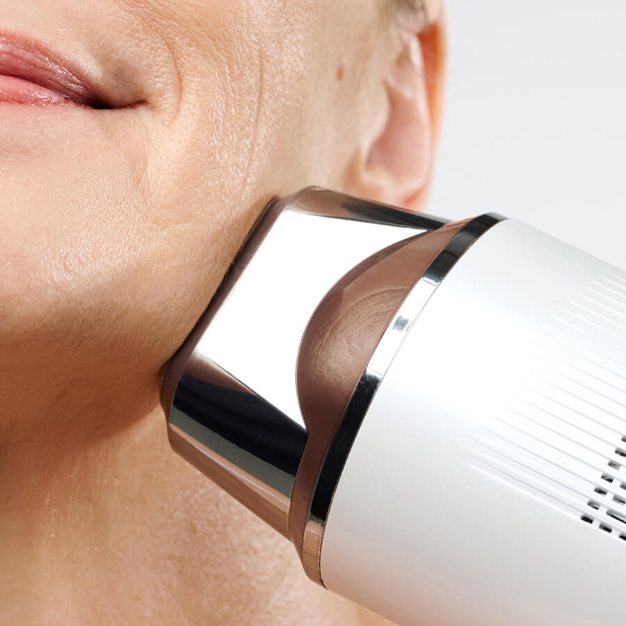 laser hair removal