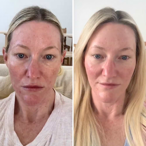 CurrentBody Skin Green Tea Serum | CurrentBody USA CurrentBody Skin Green Tea Serum | CurrentBody USA