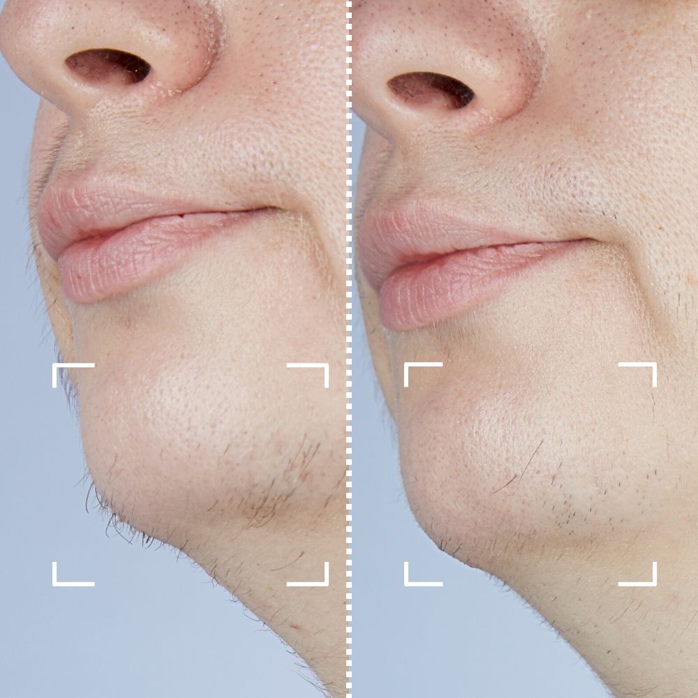 


Before &amp; After