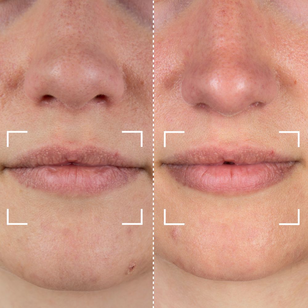 


Before &amp; After