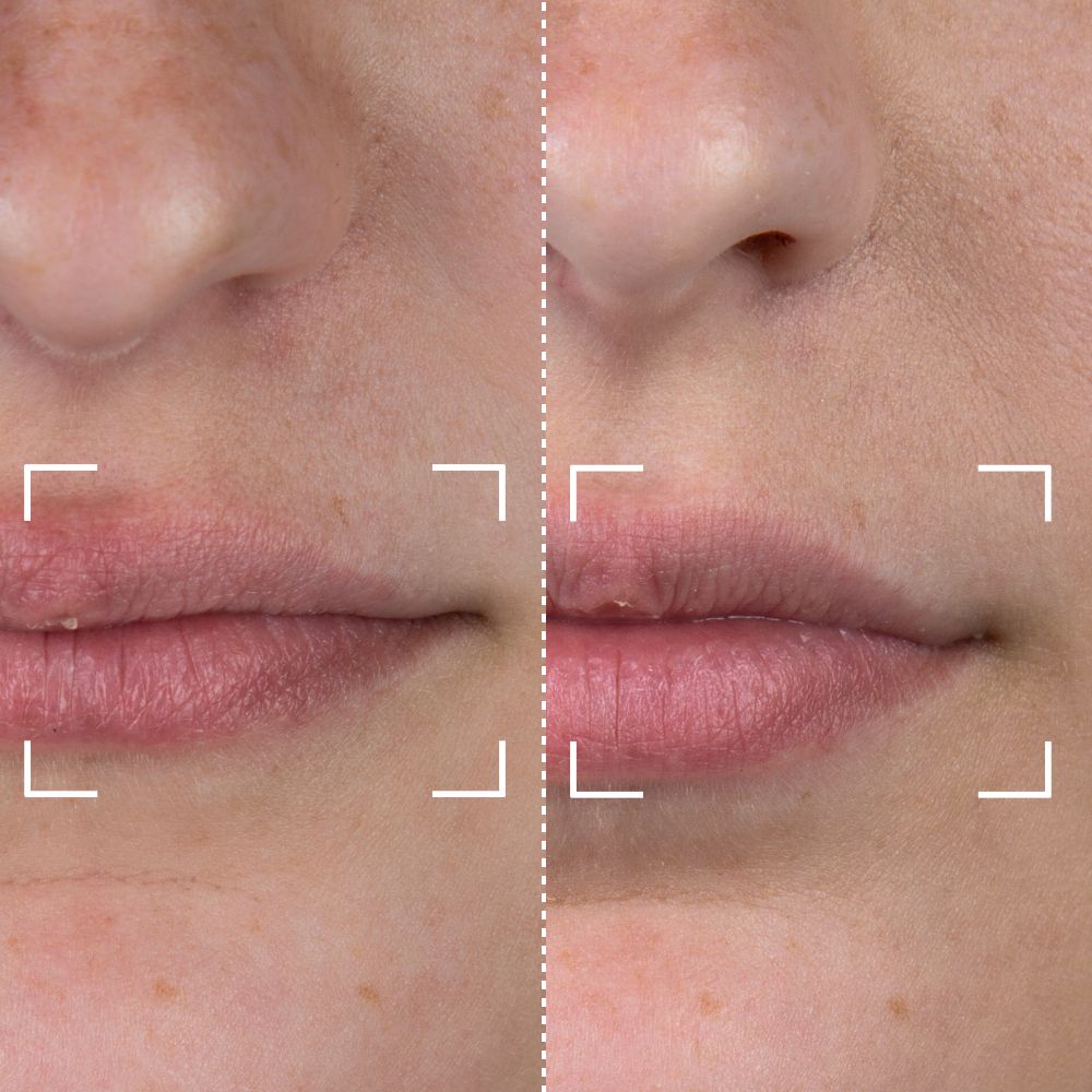 


Before &amp; After