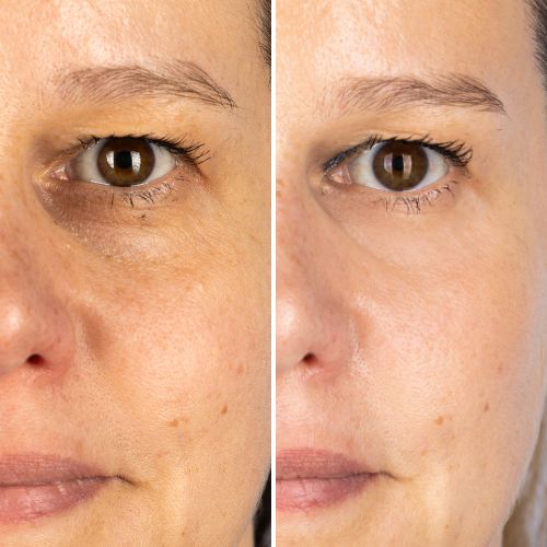 


Before &amp; After