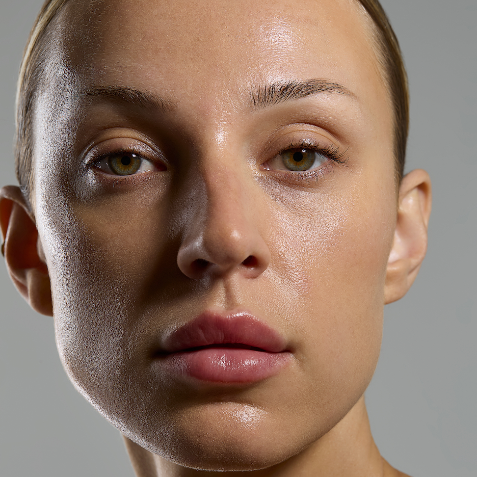 ¿Qué es el microneedling RF?