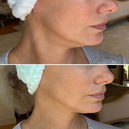 


Before &amp; After