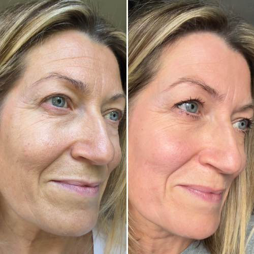 


Before &amp; After
