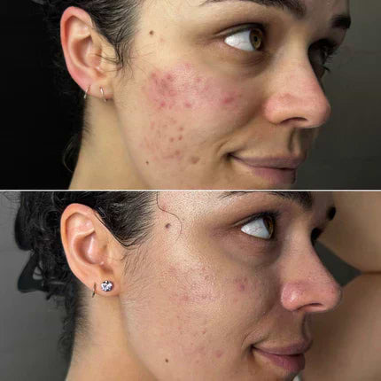 Red Light Therapy Before & After: Pictures and Results