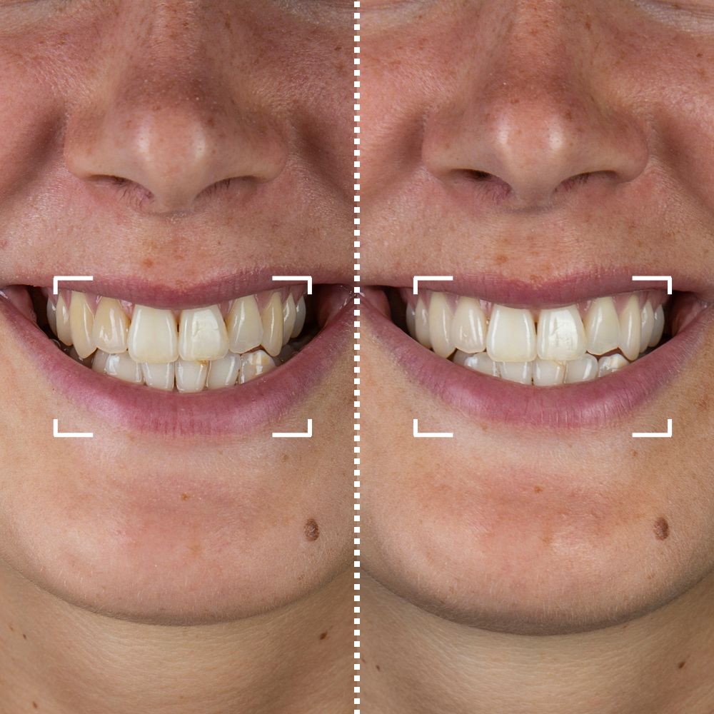 Promotes healthy gums