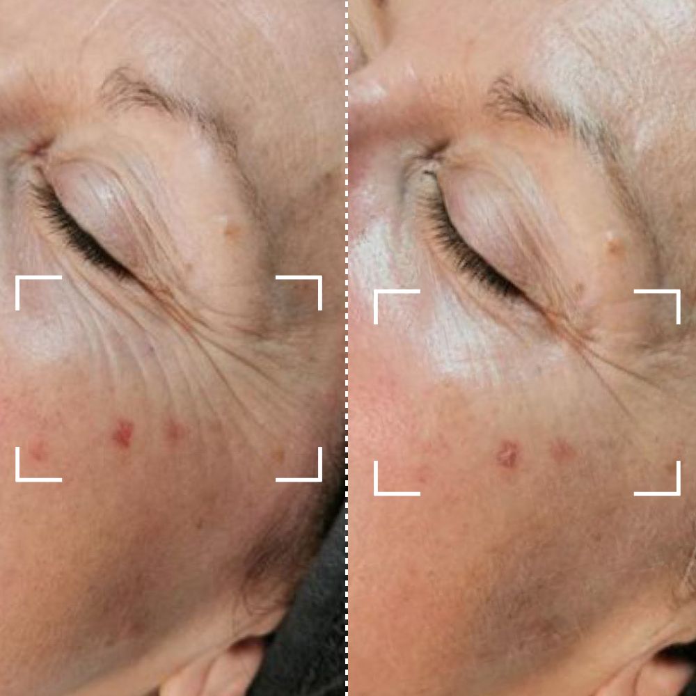 Anti-Ageing