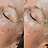 Anti-Ageing
