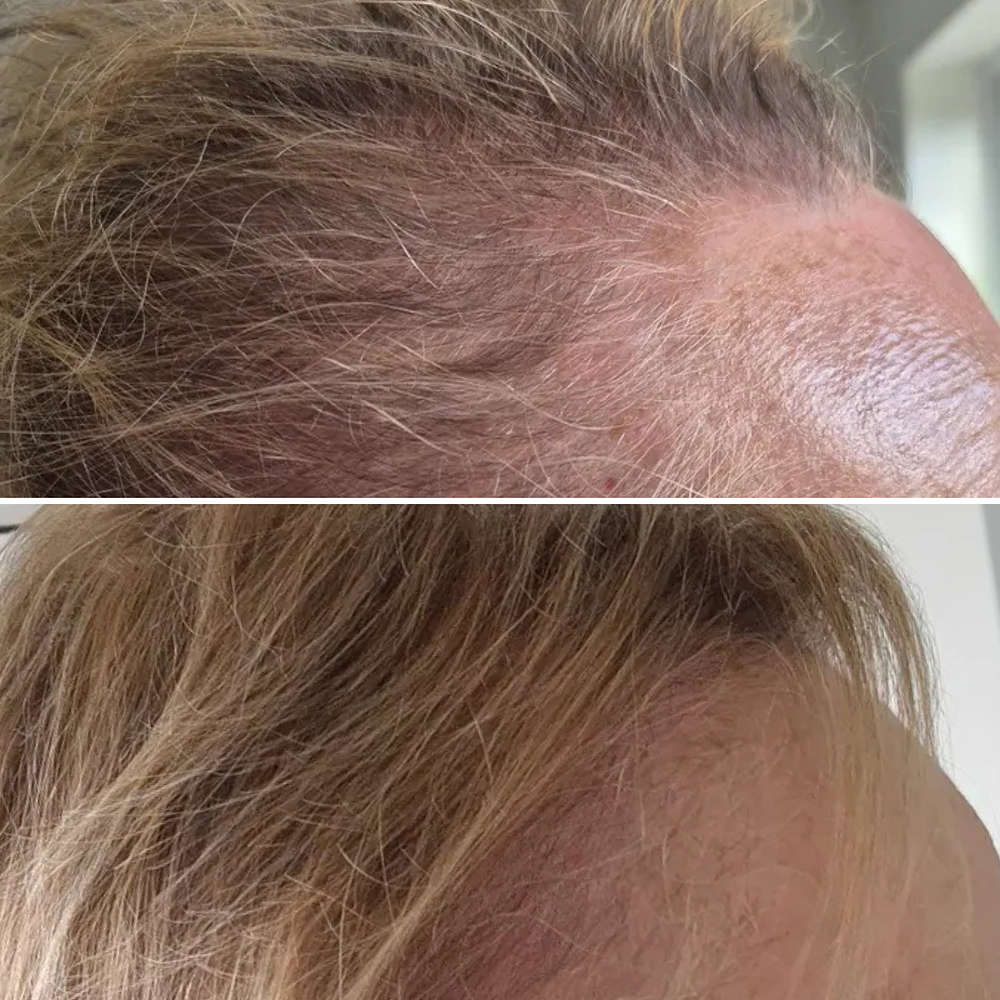


Before &amp; After