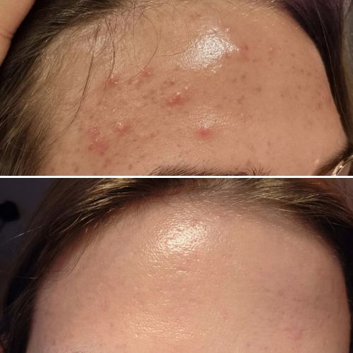 5 times a week for 8 weeks.