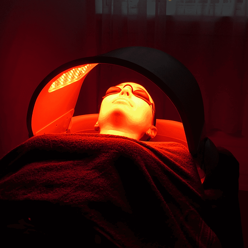 ¿Cómo tratar el acné con terapia de luz LED?
