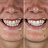 Promotes healthy gums