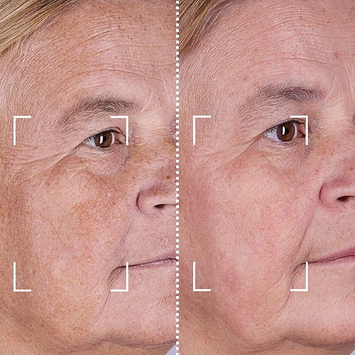 CurrentBody Skin Special LED Kit