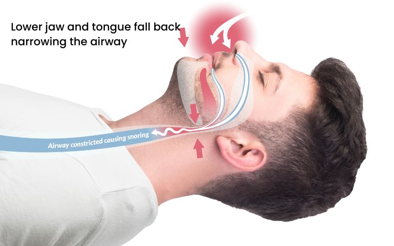 diagram of snoring at night