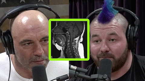 Joe Rogan Sleep Apnea Snoring Mouthpiece