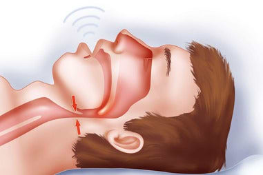 diagram showing airways while sleeping