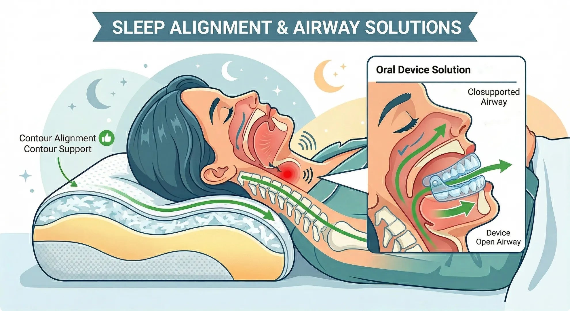 The Snoring Connection: Why a Pillow Isn