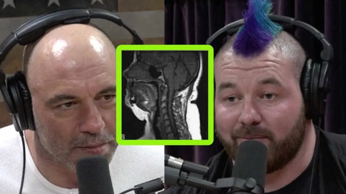 Joe Rogan's Battle With Sleep Apnea And His Mouthpiece Use